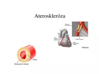 ateroskler za