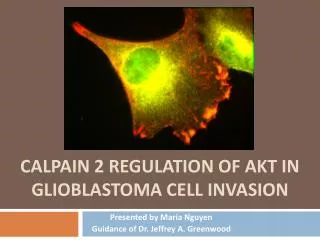 Calpain 2 regulation of Akt in glioblastoma cell invasion