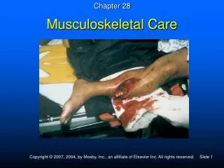 Musculoskeletal Care