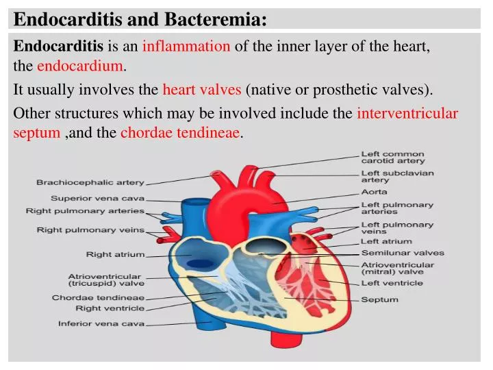 endocarditis and bacteremia
