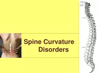 Spine Curvature Disorders