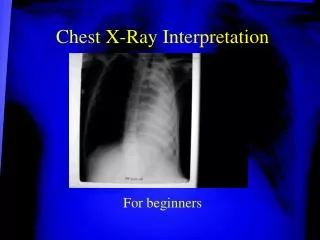 Chest X-Ray Interpretation