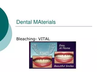 Dental MAterials