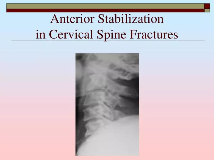 anterior stabilization in cervical spine fractures