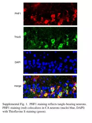 Supplemental Fig. 1. PHF1 staining reflects tangle-bearing neurons.