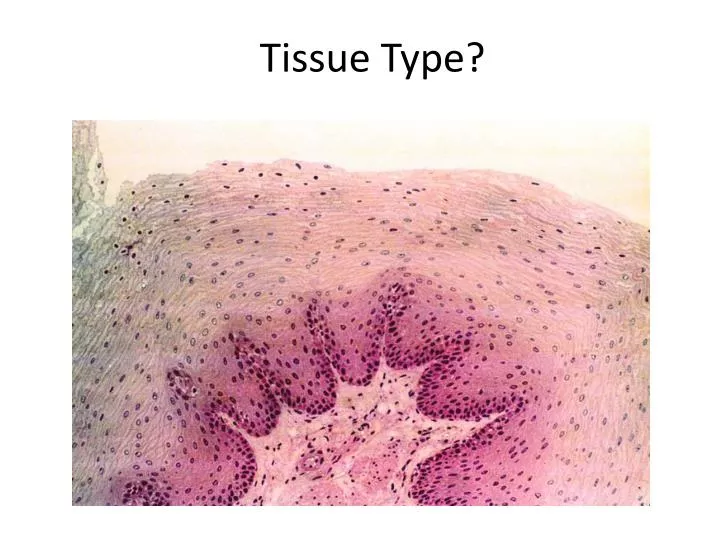 tissue type