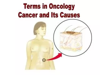 Terms in Oncology &amp; Its Causes