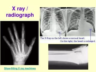 X ray / radiograph