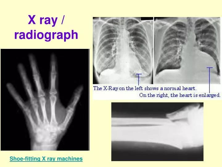 x ray radiograph