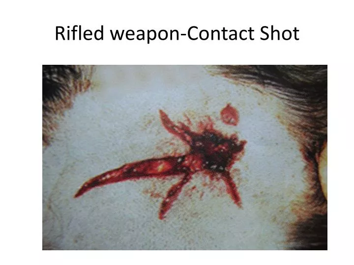 rifled weapon contact shot