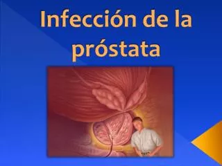 Infección de la próstata