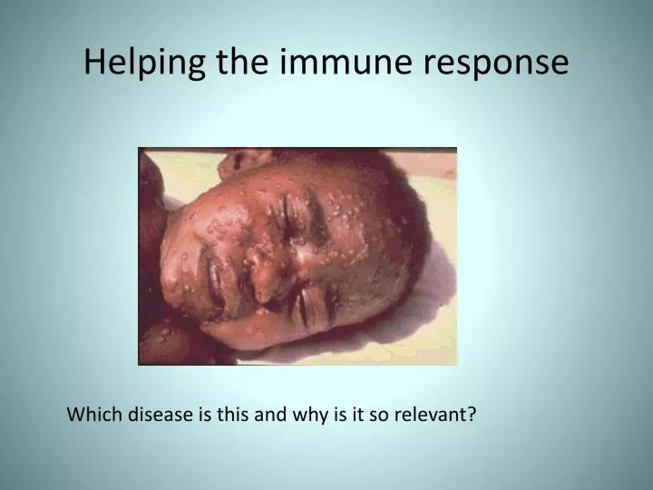 helping the immune response
