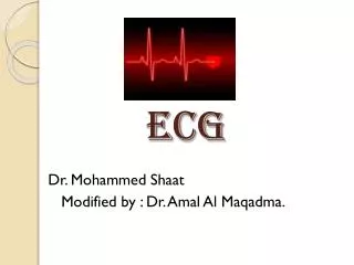 ECG