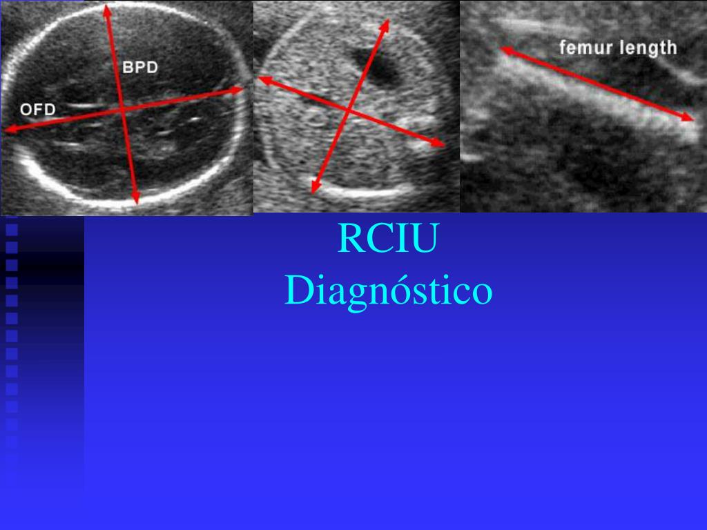 PPT - RCIU Diagnóstico PowerPoint Presentation, free download - ID:6926496