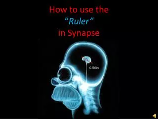How to use the “ Ruler” in Synapse