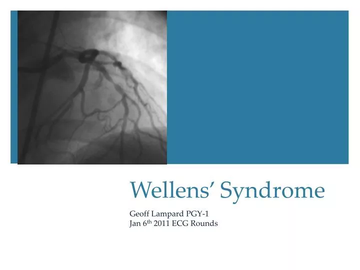 wellens syndrome