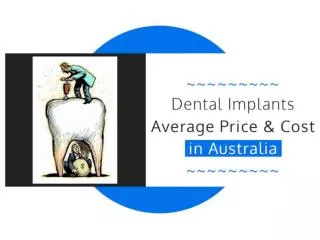 Average Dental Implant Cost in Sydney and Melbourne