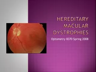 Hereditary Macular dystrophies