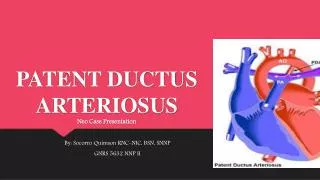 PATENT DUCTUS ARTERIOSUS Neo Case Presentation