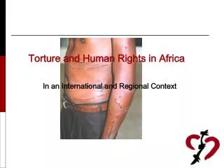 Torture and Human Rights in Africa