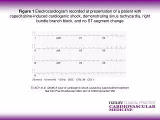 To ACY et al. (2008) A case of cardiogenic shock caused by capecitabine treatment