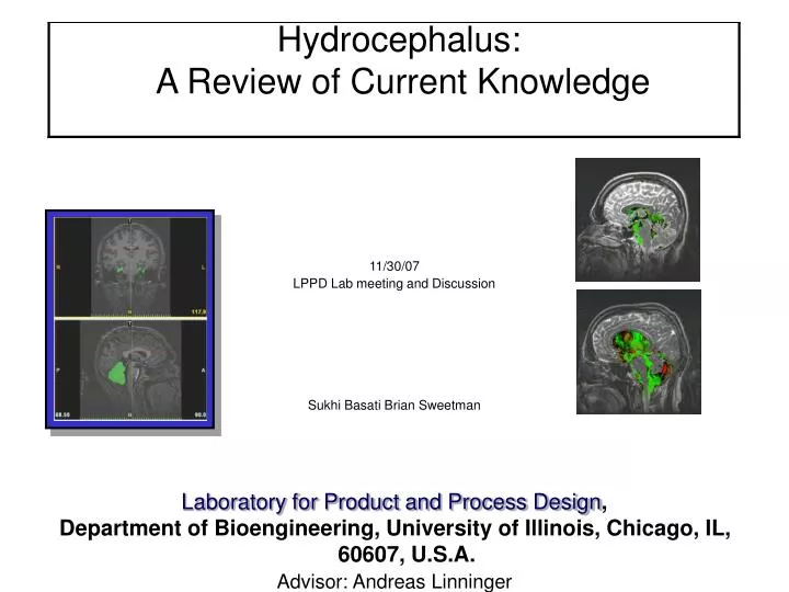 hydrocephalus a review of current knowledge