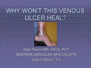 WHY WON’T THIS VENOUS ULCER HEAL?