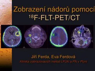 Zobrazení nádorů pomocí 18 F-FLT-PET/CT