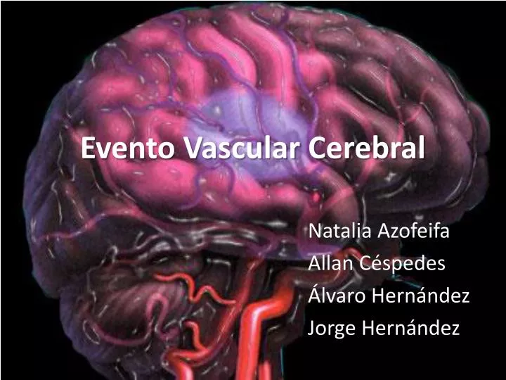 evento vascular cerebral