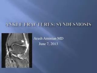 Ankle Fractures: syndesmosis