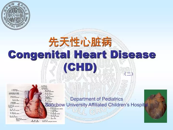 congenital heart disease chd