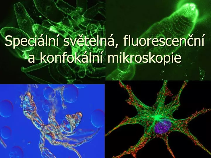 speci ln sv teln fluorescen n a konfok ln mikroskopie