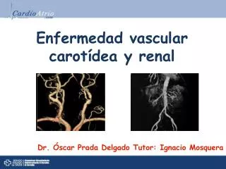 Enfermedad vascular carotídea y renal