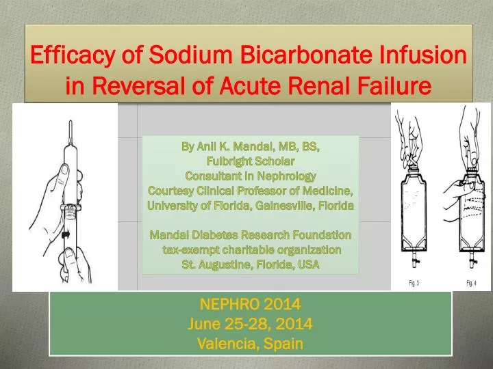 efficacy of sodium bicarbonate infusion in reversal of acute renal failure