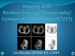 Imaging with Positron Emission Tomography/ Computed Tomography ( PET/CT)