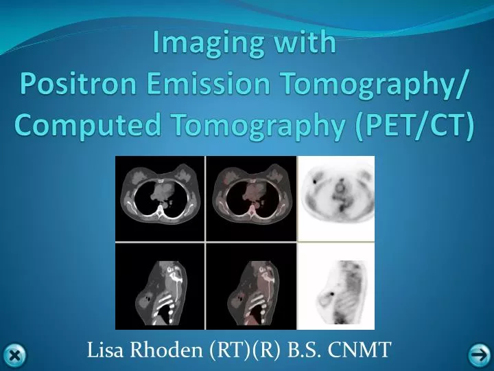 imaging with positron emission tomography computed tomography pet ct