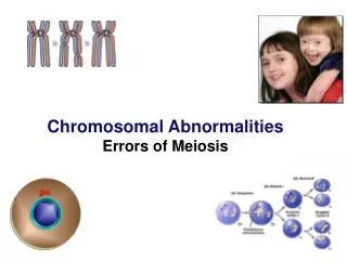 Chromosomal Abnormalities Errors of Meiosis