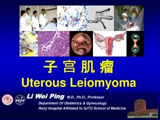 子 宫 肌 瘤 Uterous Leiomyoma
