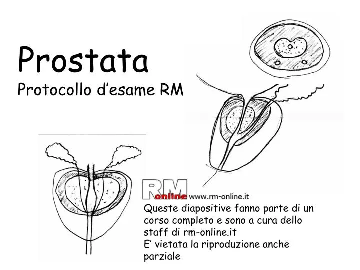 prostata protocollo d esame rm