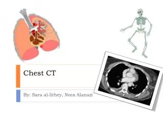 Chest CT