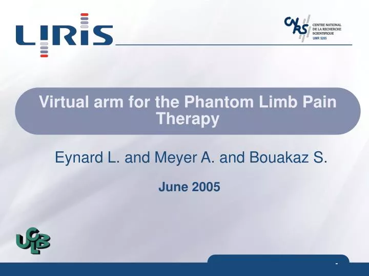 virtual arm for the phantom limb pain therapy