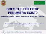 DOES THE EPILEPTIC PENUMBRA EXIST?