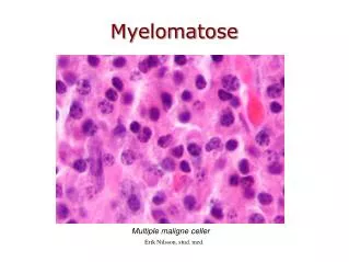 Myelomatose