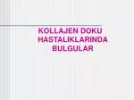 KOLLAJEN DOKU HASTALIKLARINDA BULGULAR - slide 1