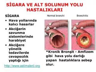 SİGARA VE ALT SOLUNUM YOLU HASTALIKLARI