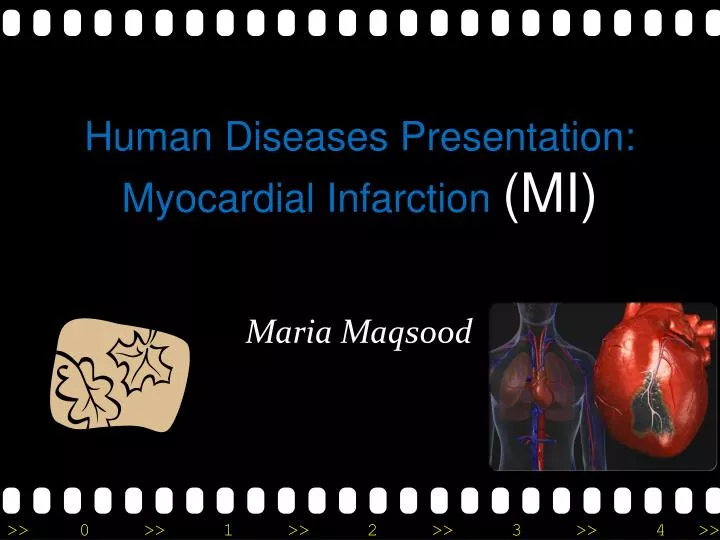 human diseases presentation myocardial infarction mi