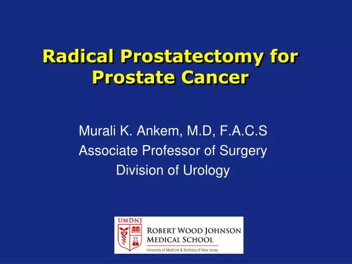 radical prostatectomy for prostate cancer