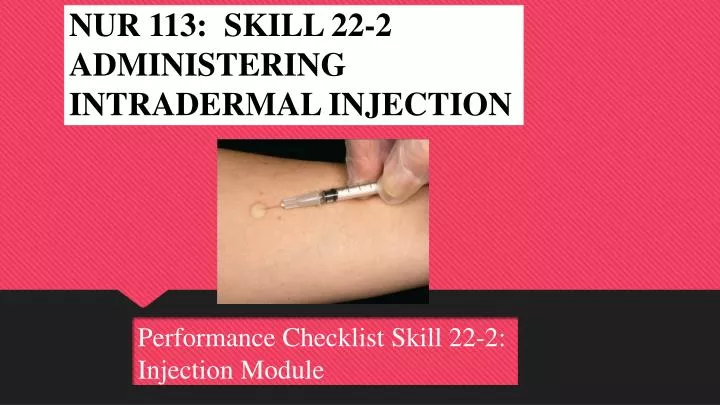 nur 113 skill 22 2 administering intradermal injection