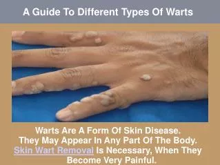 A Guide To Different Types Of Warts