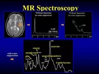 MR Spectroscopy